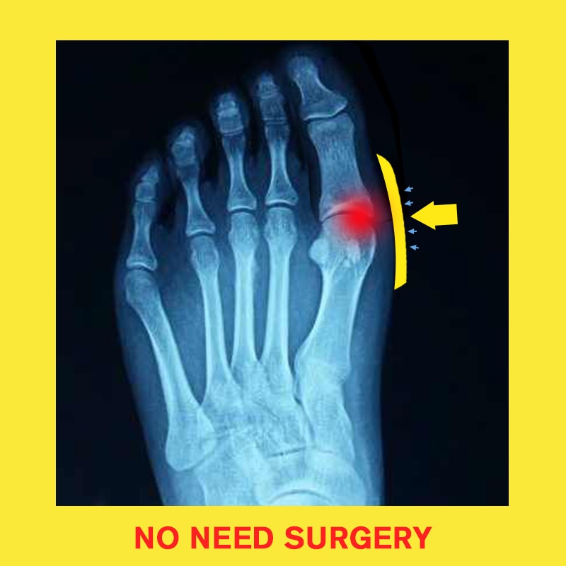 SANDÁLIA ORTOPÉDICA COMFORTLIFE